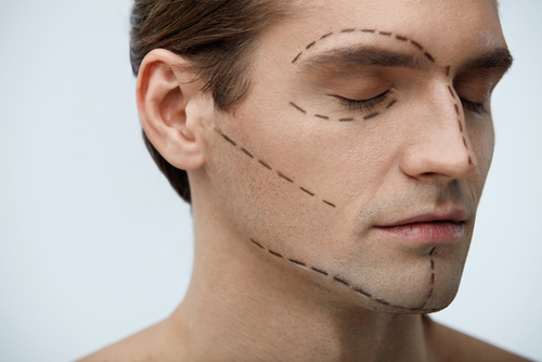 Top 3 Reasons Men Undergo Plastic Surgery